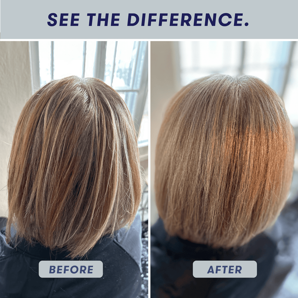 before-after