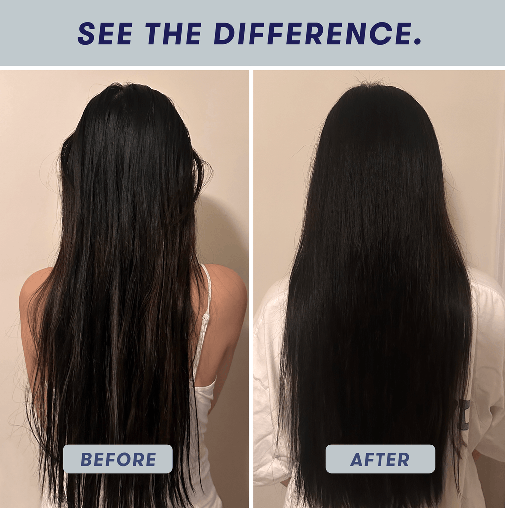 before-after