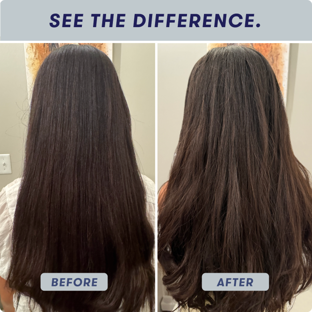 before-after
