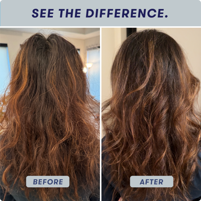 before-after